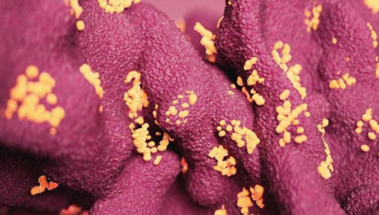 Çin’de ortaya çıkan Langya virüsü sıkı önlemler gerektirebilir
